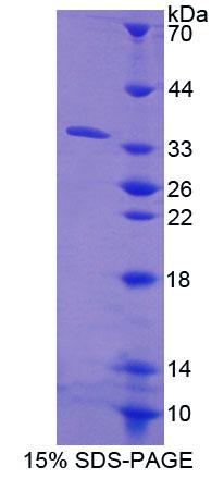 Carboxylesterase 1 / CES1 Protein - Recombinant Carboxylesterase 1 By SDS-PAGE