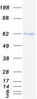 Carboxylesterase 1 / CES1 Protein - Purified recombinant protein CES1 was analyzed by SDS-PAGE gel and Coomassie Blue Staining