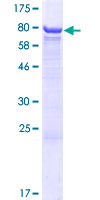 Carboxylesterase 3 / CES3 Protein - 12.5% SDS-PAGE of human CES3 stained with Coomassie Blue