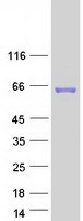 Carboxylesterase 3 / CES3 Protein - Purified recombinant protein CES3 was analyzed by SDS-PAGE gel and Coomassie Blue Staining