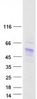 Carboxylesterase 5A / CES5A Protein - Purified recombinant protein CES5A was analyzed by SDS-PAGE gel and Coomassie Blue Staining