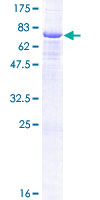 Carboxypeptidase A5 / CPA5 Protein - 12.5% SDS-PAGE of human CPA5 stained with Coomassie Blue