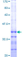 CARD10 / CARMA3 Protein - 12.5% SDS-PAGE Stained with Coomassie Blue.