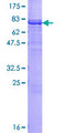 CARD14 Protein - 12.5% SDS-PAGE of human CARD14 stained with Coomassie Blue