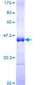 CARD14 Protein - 12.5% SDS-PAGE Stained with Coomassie Blue.