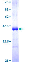 CARD14 Protein - 12.5% SDS-PAGE Stained with Coomassie Blue.