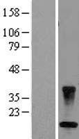 CARD16 / COP Protein - Western validation with an anti-DDK antibody * L: Control HEK293 lysate R: Over-expression lysate