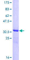 CARD16 / COP Protein - 12.5% SDS-PAGE of human COP1 stained with Coomassie Blue