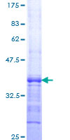 CARD16 / COP Protein - 12.5% SDS-PAGE Stained with Coomassie Blue.
