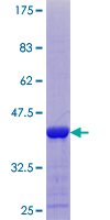 CARD17 / INCA Protein - 12.5% SDS-PAGE of human INCA stained with Coomassie Blue