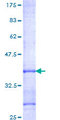 CARD18 / ICEBERG Protein - 12.5% SDS-PAGE Stained with Coomassie Blue.