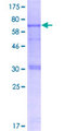 CARD8 / Cardinal / TUCAN Protein - 12.5% SDS-PAGE of human CARD8 stained with Coomassie Blue