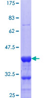 CARD8 / Cardinal / TUCAN Protein - 12.5% SDS-PAGE Stained with Coomassie Blue.