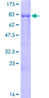 CARD9 Protein - 12.5% SDS-PAGE of human CARD9 stained with Coomassie Blue