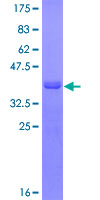 CARD9 Protein - 12.5% SDS-PAGE Stained with Coomassie Blue.