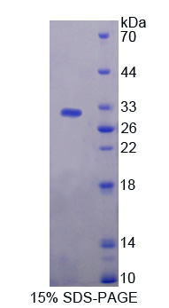 CARD9 Protein - Recombinant  Caspase Recruitment Domain Family, Member 9 By SDS-PAGE