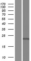 Cardiolipin Synthase / CRLS1 Protein - Western validation with an anti-DDK antibody * L: Control HEK293 lysate R: Over-expression lysate