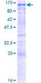 CARF / ALS2CR8 Protein - 12.5% SDS-PAGE of human ALS2CR8 stained with Coomassie Blue