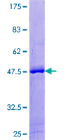 CARHSP1 Protein - 12.5% SDS-PAGE of human CARHSP1 stained with Coomassie Blue