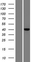 CARKD Protein - Western validation with an anti-DDK antibody * L: Control HEK293 lysate R: Over-expression lysate