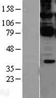 CARMA1 / CARD11 Protein - Western validation with an anti-DDK antibody * L: Control HEK293 lysate R: Over-expression lysate