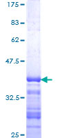 CARMA1 / CARD11 Protein - 12.5% SDS-PAGE Stained with Coomassie Blue.