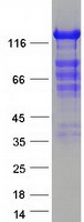 CARMA1 / CARD11 Protein - Purified recombinant protein CARD11 was analyzed by SDS-PAGE gel and Coomassie Blue Staining