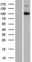 CARNS1 Protein - Western validation with an anti-DDK antibody * L: Control HEK293 lysate R: Over-expression lysate