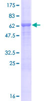 CARNS1 Protein - 12.5% SDS-PAGE of human KIAA1394 stained with Coomassie Blue