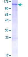 Carom / FCHSD2 Protein - 12.5% SDS-PAGE of human FCHSD2 stained with Coomassie Blue