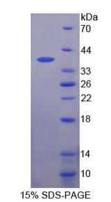 CARP / ANKRD1 Protein - Recombinant Ankyrin Repeat Domain Protein 1 (ANKRD1) by SDS-PAGE