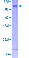 CARS1 / CARS Protein - 12.5% SDS-PAGE of human CARS stained with Coomassie Blue