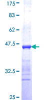 CARS1 / CARS Protein - 12.5% SDS-PAGE Stained with Coomassie Blue.