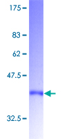 CARTPT / CART Protein - 12.5% SDS-PAGE of human CART stained with Coomassie Blue