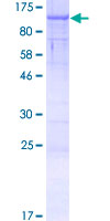 CASC1 Protein - 12.5% SDS-PAGE of human CASC1 stained with Coomassie Blue
