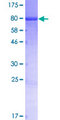 CASC4 Protein - 12.5% SDS-PAGE of human CASC4 stained with Coomassie Blue