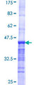 CASC5 Protein - 12.5% SDS-PAGE Stained with Coomassie Blue