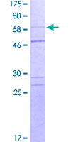 CASP1 / Caspase 1 Protein - 12.5% SDS-PAGE of human CASP1 stained with Coomassie Blue