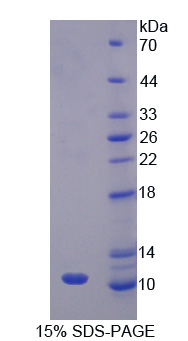 CASP1 / Caspase 1 Protein - Recombinant Caspase 1 By SDS-PAGE