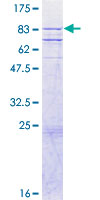CASP10 / Caspase 10 Protein - 12.5% SDS-PAGE of human CASP10 stained with Coomassie Blue