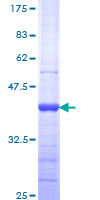 CASP10 / Caspase 10 Protein - 12.5% SDS-PAGE Stained with Coomassie Blue.