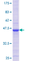 CASP10 / Caspase 10 Protein - 12.5% SDS-PAGE Stained with Coomassie Blue.