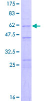 CASP2 / Caspase 2 Protein - 12.5% SDS-PAGE of human CASP2 stained with Coomassie Blue