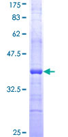 CASP2 / Caspase 2 Protein - 12.5% SDS-PAGE Stained with Coomassie Blue.
