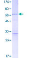 CASP3 / Caspase 3 Protein - 12.5% SDS-PAGE of human CASP3 stained with Coomassie Blue