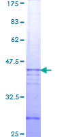 CASP3 / Caspase 3 Protein - 12.5% SDS-PAGE Stained with Coomassie Blue.