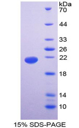 CASP3 / Caspase 3 Protein - Recombinant Caspase 3 By SDS-PAGE