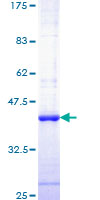 CASP6 / Caspase 6 Protein - 12.5% SDS-PAGE Stained with Coomassie Blue.