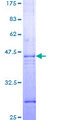CASP7 / Caspase 7 Protein - 12.5% SDS-PAGE Stained with Coomassie Blue.