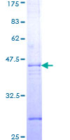 CASP7 / Caspase 7 Protein - 12.5% SDS-PAGE Stained with Coomassie Blue.